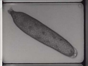 Embryonalentwicklung der Libelle Ischnura elegans - Ausschaltversuche