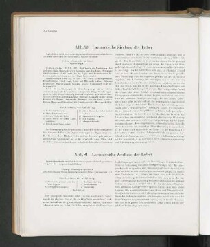 Abb. 90 Laennesche Zirrhose der Leber