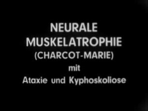 Neurale Muskelatrophie (Charcot-Marie) mit Ataxie und Kyphoskoliose