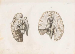 Neurologie