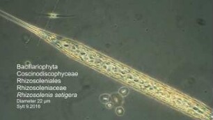 Rhizosolenia ssp. Sylt 2016