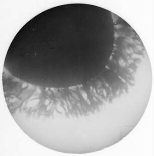 Spore aus der Moskauer Braunkohle (R. Potonié) : Geologie | Kohlengeologie | Das mikroskopische Bild der Kohle (Mikroskopische Kohlenpetrographie)