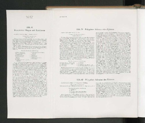 Abb. 81 Resezierter Magen mit Karzinom