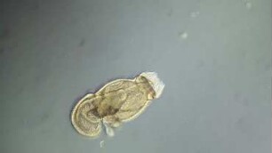 Phoronis muelleri, actinotrocha larva, Helgoland 2012