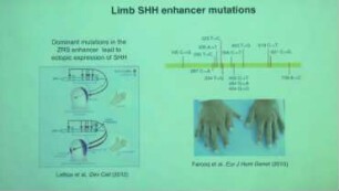Gene regulatory network rewiring by disease variants and transcription factor isoforms