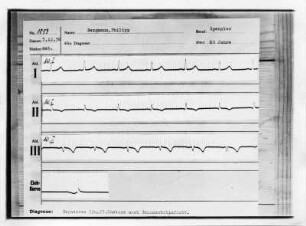 Elektrokardiogramm