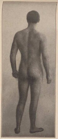 Fotografie eines unbekleideten Manns (Rückenansicht)