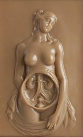 Gynäko-anatomisches Halbrelief "Marburger Venus" Replik