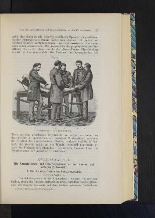 Zweites Capitel. Die Amputaion und Exarticulation an der oberen und unteren Extremität.