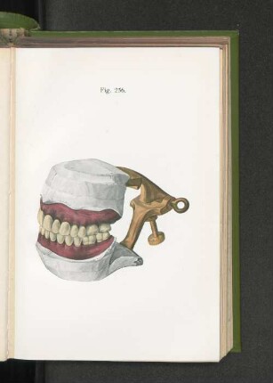Fig. 256.