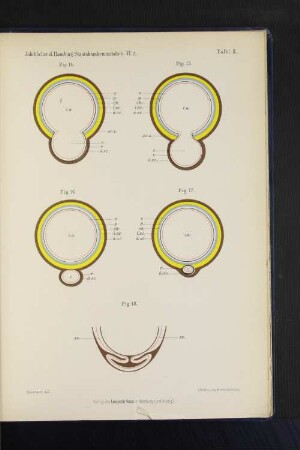 Jahrbücher d. Hamburg. Staatskrankenanstalten. VI. 2. Tafel II.