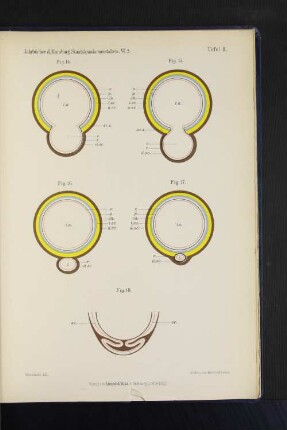 Jahrbücher d. Hamburg. Staatskrankenanstalten. VI. 2. Tafel II.