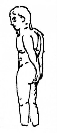Rachepuppe. Junge männliche nackte Figur. Hände auf den Rücken. Körper mit eingeritzten Namen bedeckt. Eine Hälfte abgeschmolzen, Füße weggebrochen