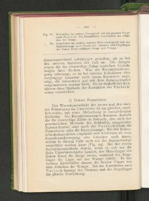 c) Untere Prämolaren.