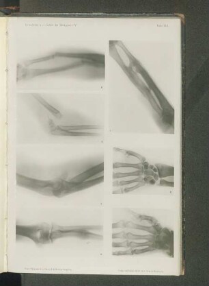 Tafel XIII