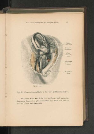 Fig. 21. Fossa retromandibularis bei weit geöffnetem Munde.