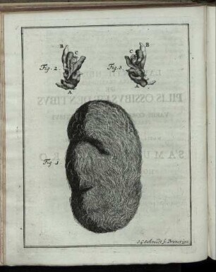 Laurentii Heisteri Epistola Gratulatoria De Pilis Ossibus Et Dentibus In Variis Corporis Humani Partibus Praeter Naturam Repertis Qua ... Medicinae Candidato Samueli Pauero posonio Hungaro Honores Doctorales Gratulatur.