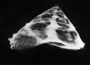 Trochus niloticus (Kreiselschnecke), Röntgenaufnahme, Seitenansicht