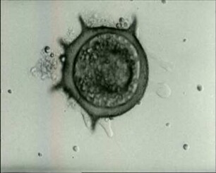 Centropyxis aculeata (Testacea) - Bewegung und Fortpflanzung