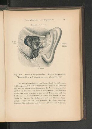 Fig. 139. Recessus epitympanicus. Antrum tympanicum. Warzenzellen und Sinus transversus.