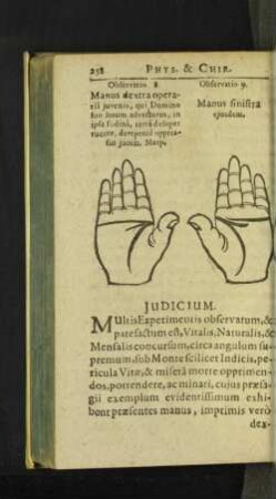 Observatio 8. Manus dextra operarii juvenis, qui Domino suo ... [u. a.]