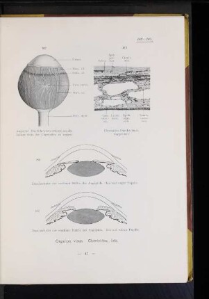 104 Durchschnitt der vorderen Hälfte des Augapfels. Iris mit enger Pupille.