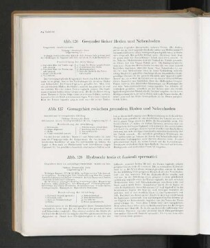 Abb. 127 Grenzgebiet zwischen gesunden Hoden und Nebenhoden
