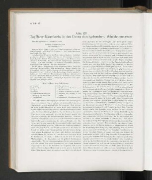 Abb. 125 Papillärer Blasenkrebs, in den Uterus durchgebrochen. Scheidenmetastase