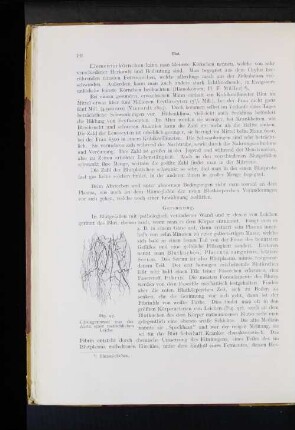 Gerinnung.