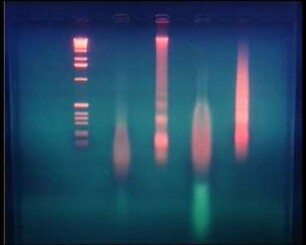 Molekularbiologische Analyse alter DNA