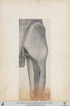 Figura XXXV.