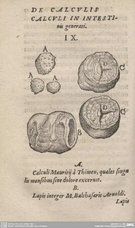 DE CALCULIS CALCULI IN INTESTINIS generati. IX.