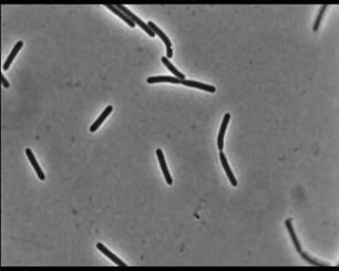 Chondromyces apiculatus (Myxobacteriales) - Schwarmentwicklung und Morphogenese