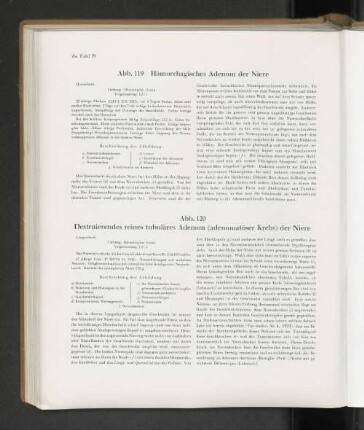 Abb. 119 Hämorrhagisches Adenom der Niere