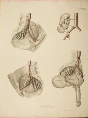 Seltene Abweichung der Arterien der rechten Niere aus dem Leichnam eines Mannes