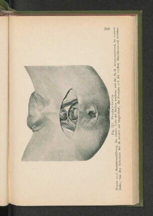 Fig. 210. Prostatatomie.