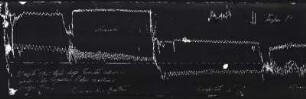 [Graphical recordings: pulse]