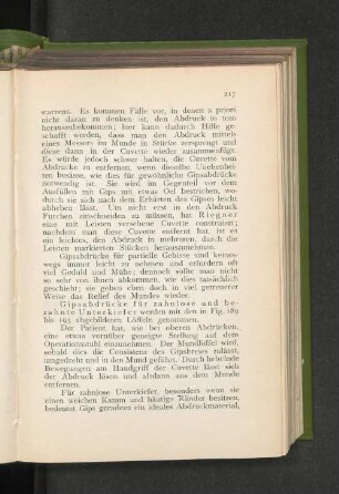 Gipsabdrücke für zahnlose und bezahnte Unterkiefer.