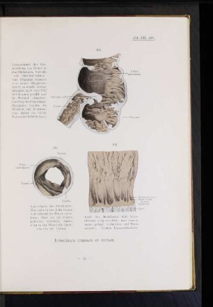 Intestinum crassum et rectum.