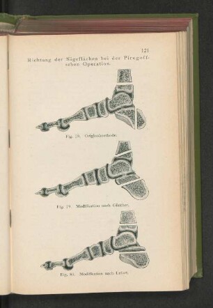 Fig. 78. Originalmethode.