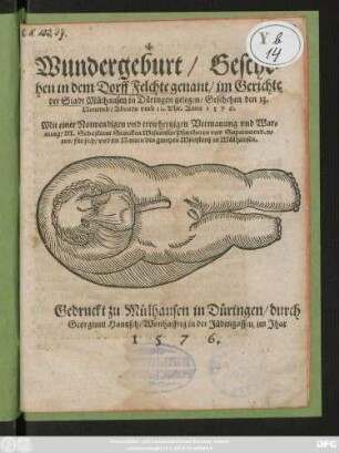 Wundergeburt/ Gesche=||hen in dem Dorff Felchte genant/ im Gerichte || der Stadt Mülhausen in Düringen gelegen/ Geschehen den 13.|| Nouemb: Abends vmb 11. Vhr. Anno 1576.|| Mit einer Notwendigen vnd trewhertzigen Vermanung vnd War=||nung/ M. Sebastiani Starcken Misnensis/ Pfarrherrn vnd Superintenden=||ten/ für sich/ vnd im Namen des gantzen Ministerij zu Mülhausen.||