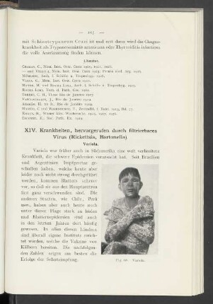 XIV. Krankheiten, hervorgerufen durch filtrierbares Virus (Rickettsia, Bartonella)