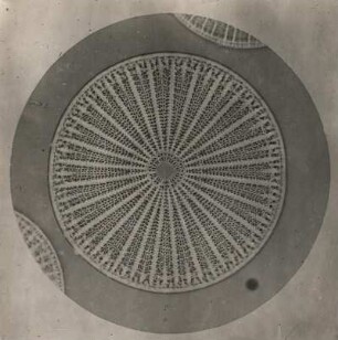 Kieselalgen oder Diatomeen (Bacillariophyta), Heliopelta. Mikro-Aufnahme