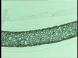 Asexual Reproduction in the Green Alga Hydrodictyon reticulatum