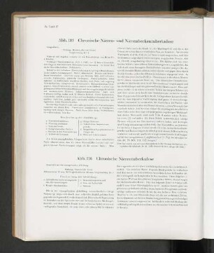 Abb. 116 Chronische Nierentuberkulose