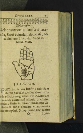 Observatio 1. Schematismus sinistrae manûs, Sueci cujusdam decollati, ...