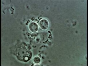 Zellbiologische Studien an Physarum polycephalum - Morphogenese der Dauerformen