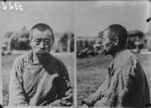 Männerportrait : Anthropometrische Aufnahme eines Mannes frontal und im Profil