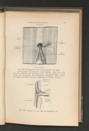 Fig. 540. Nabelgegend eines Neugeborenen von innen.