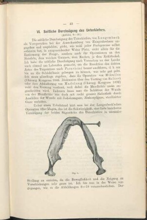VI. Seitliche Durchsägung des Unterkiefers.